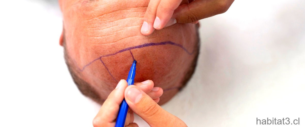 ¿Cómo limpiar una sutura infectada?