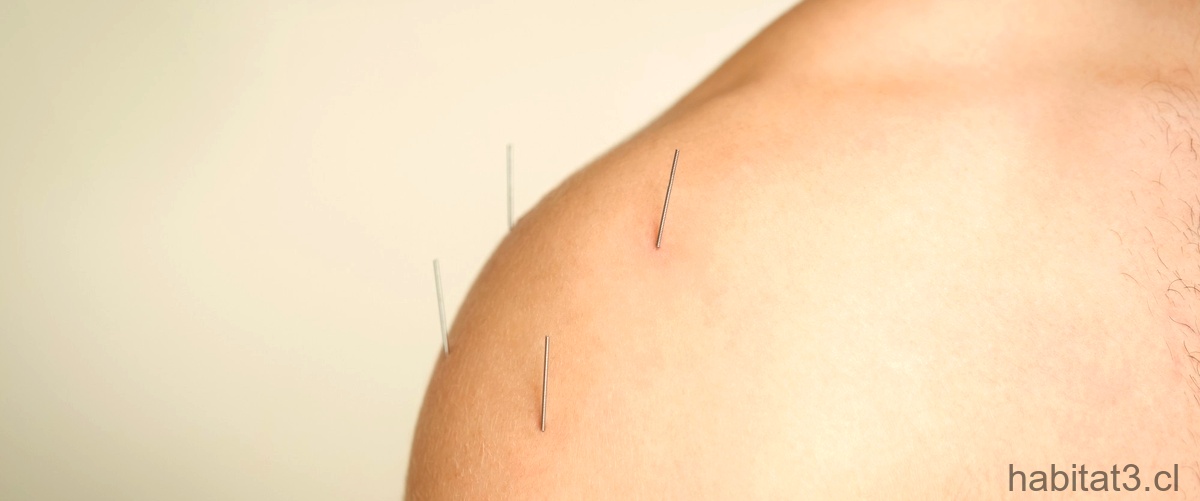 ¿Cuándo hay que dejar al aire los puntos de sutura?